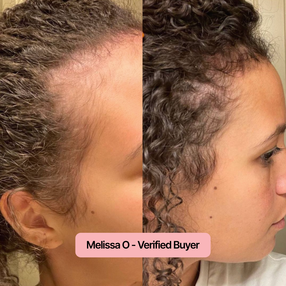 Postpartum Growth Serum™